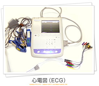 心電図（ECG）
